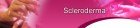 Scleroderma Adsense Website