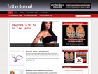 Tattoo Removal Niche Blog